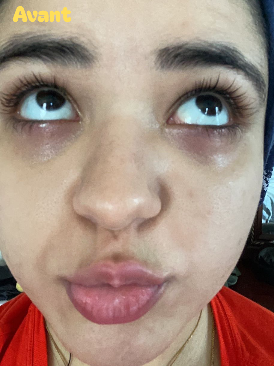 Patchs Regard d’Or 24K — Hydratation & Éclat Instantané 👁✨